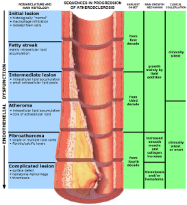 Endo_dysfunction_Athero